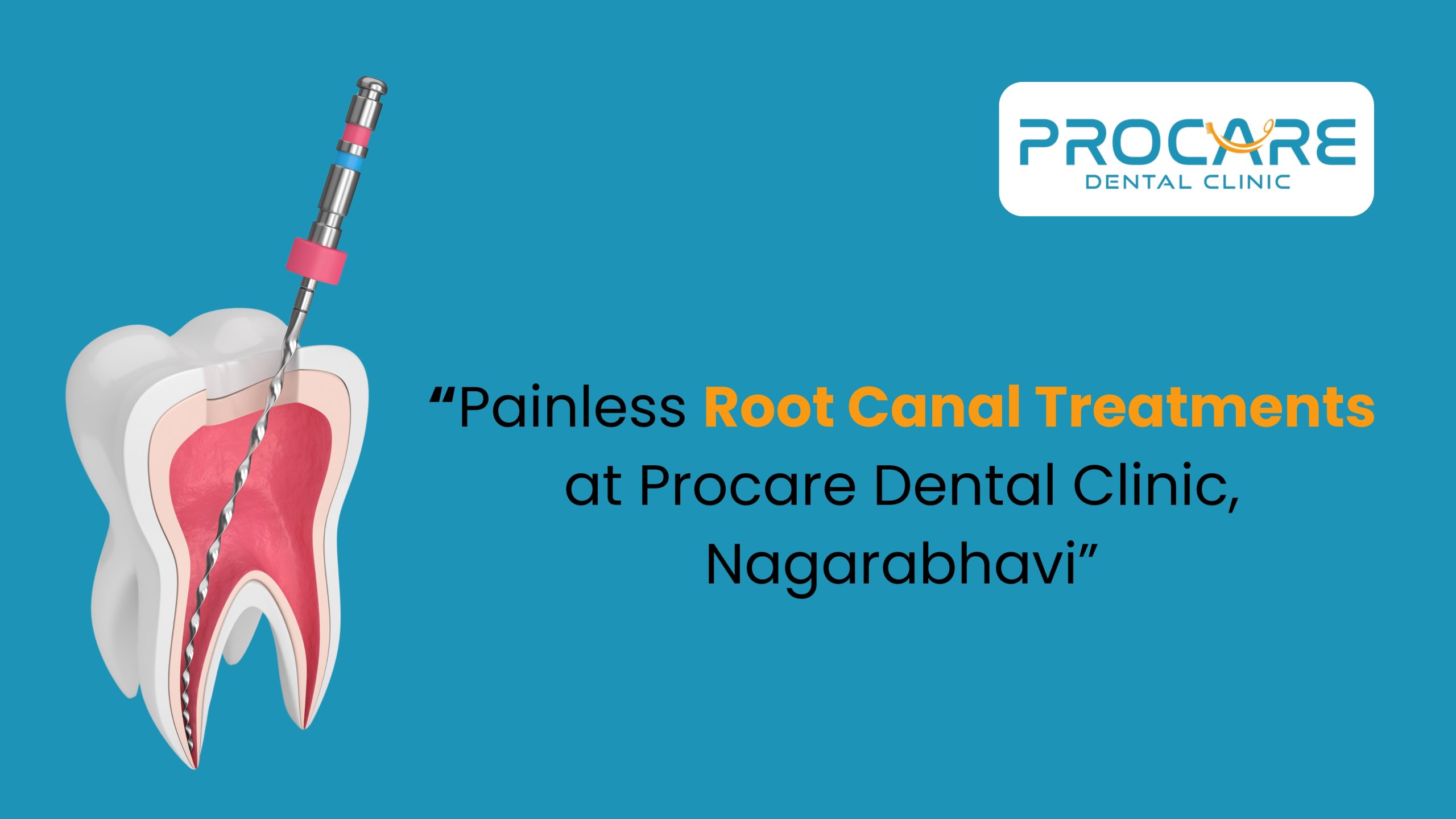 Painless Root Canal Treatments in Nagarabhavi | Procare Dental Clinic