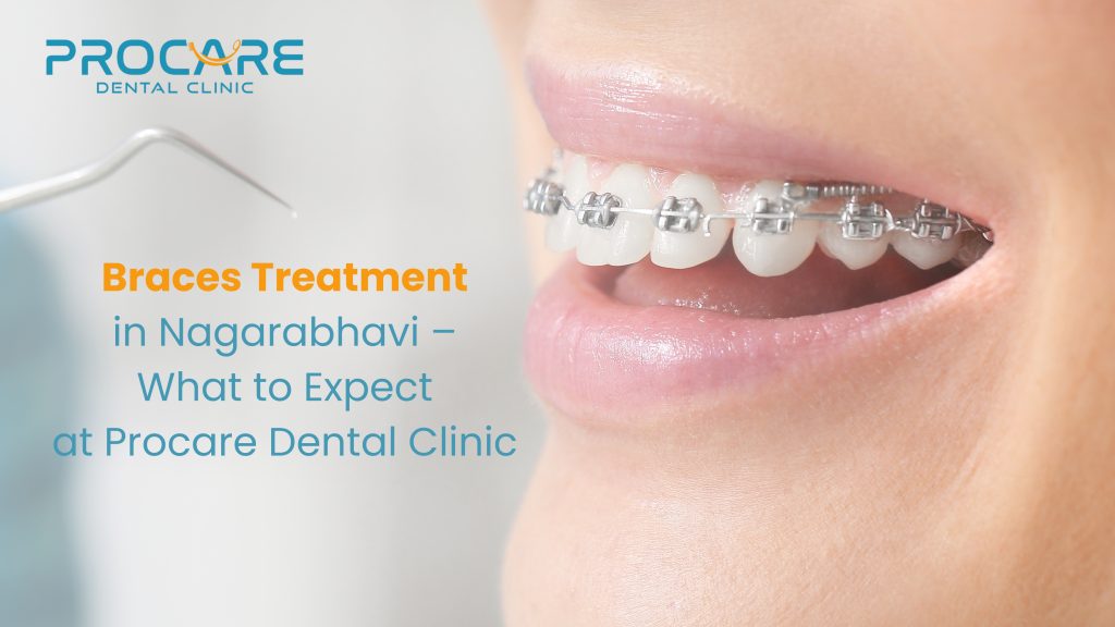 Braces Treatment in Nagarabhavi – What to Expect at Procare Dental Clinic