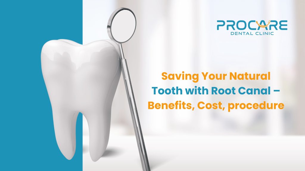 Saving Your Natural Tooth with Root Canal – Benefits, Cost & Procedure