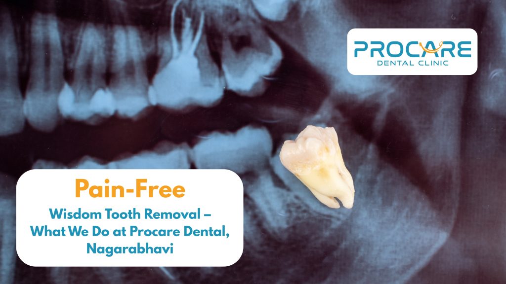 Pain-Free Wisdom Tooth Removal – What We Do at Procare Dental, Nagarabhavi