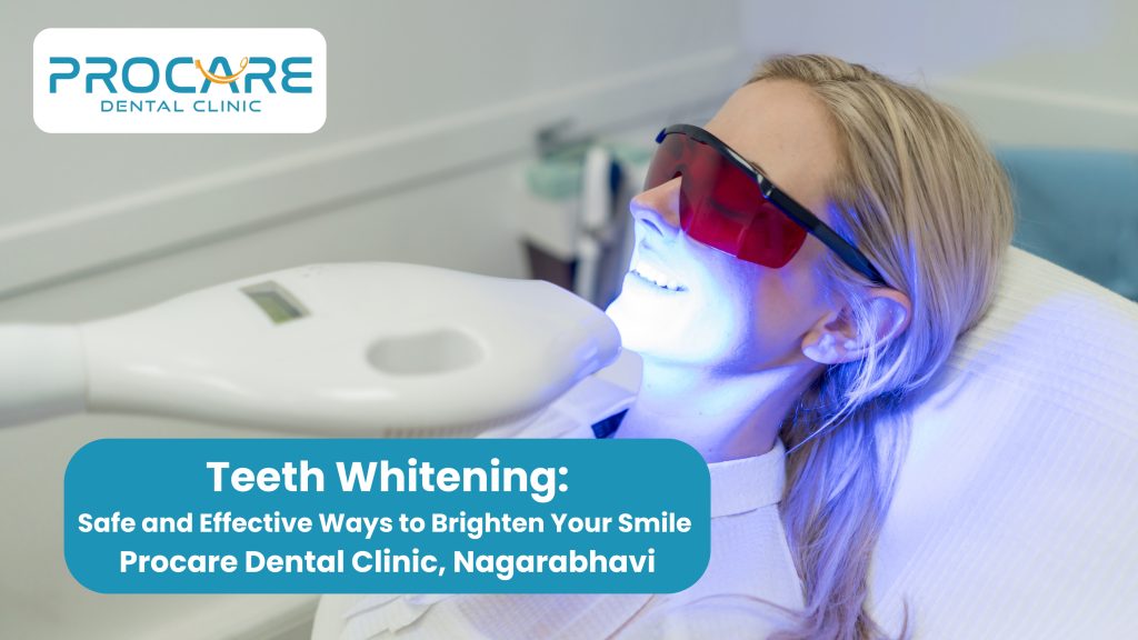 Teeth Whitening: Safe and Effective Ways to Brighten Your Smile
