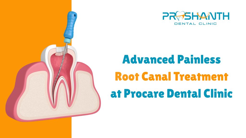 Advanced Painless Root Canal Treatment at Procare Dental Clinic