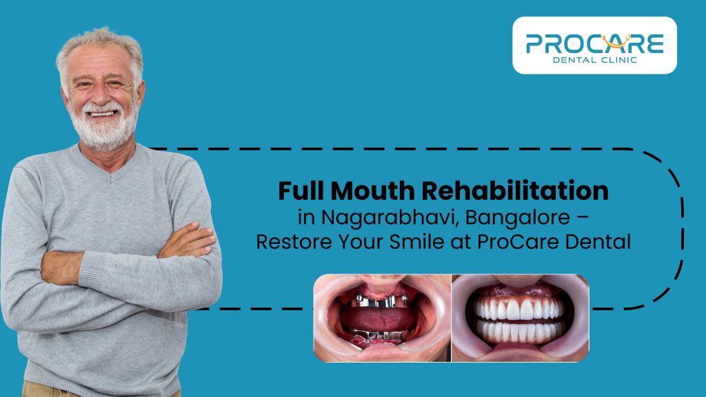 Full Mouth Rehabilitation in Nagarabhavi, Bangalore – Restore Your Smile at ProCare Dental