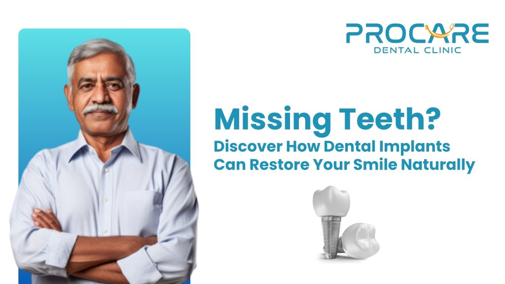 Missing Teeth? Discover How Dental Implants Can Restore Your Smile Naturally